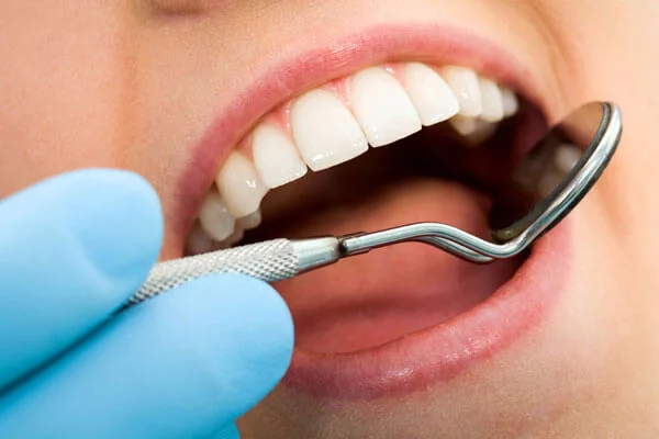 پوشش دندانپزشکی بیمه تکمیلی درمان