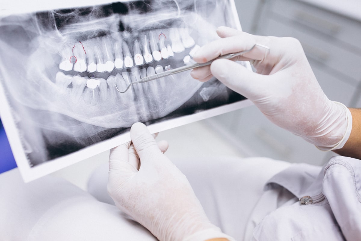 هزینه‌های دندانپزشکی شامل چه مواردی است؟