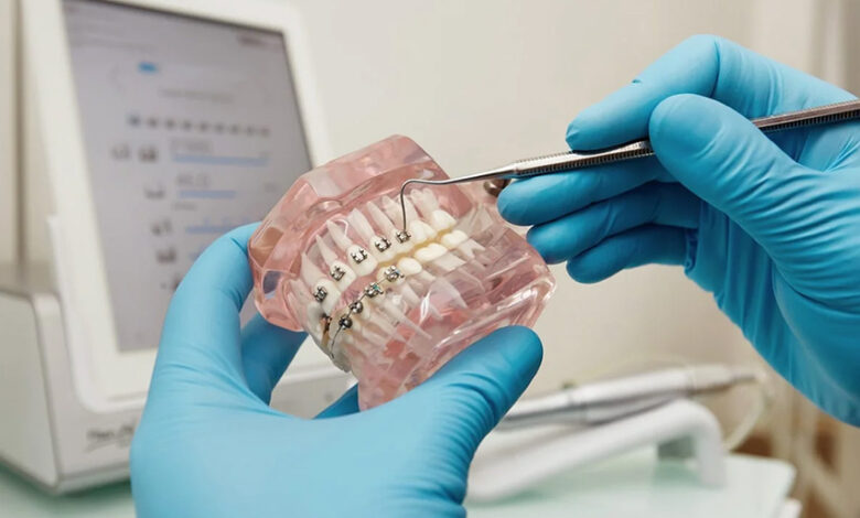 هزینه ارتودنسی با بیمه تکمیلی