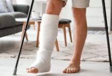 دیه شکستگی پا در تصادف